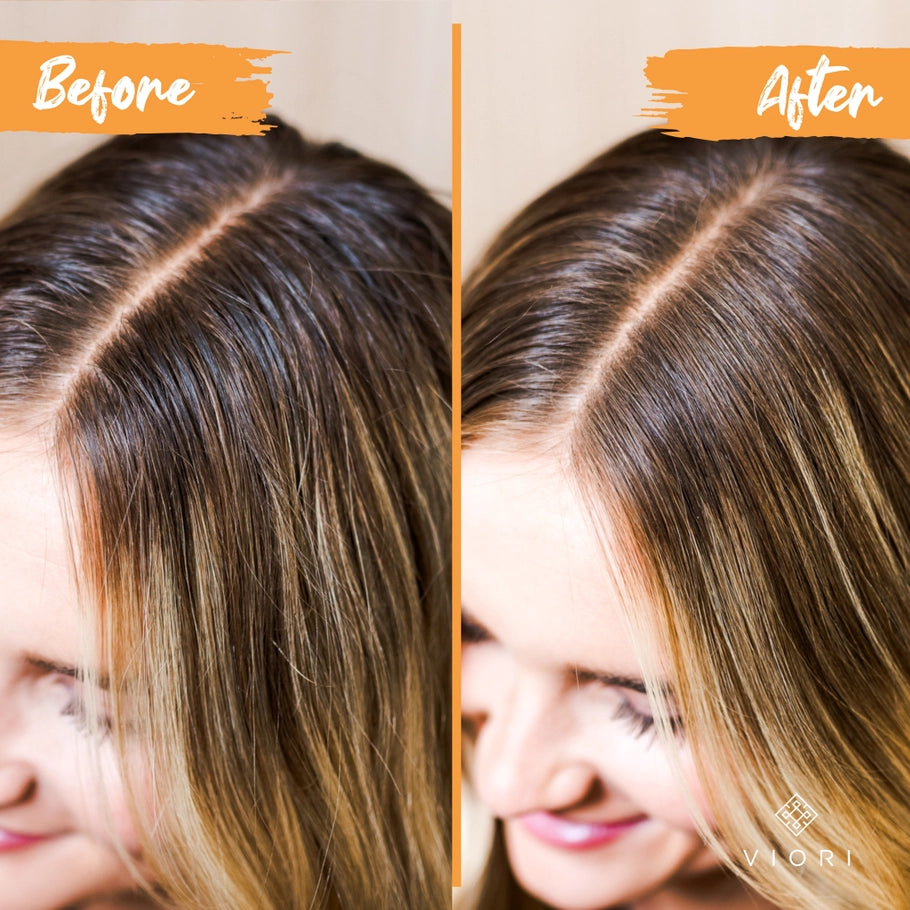 Rice Water Shampoo Bar - Citrus Zest Eo